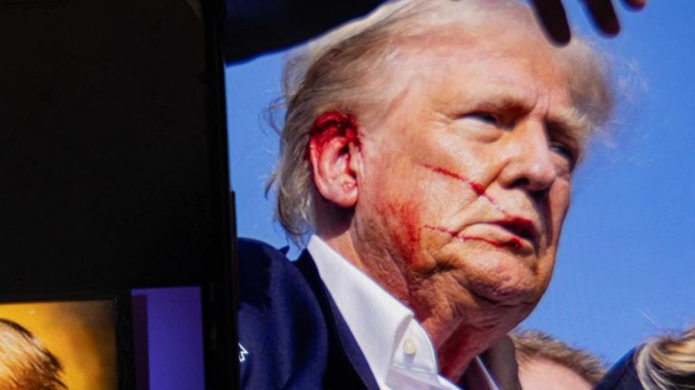 MAGA Supporter Shot at Trump Rally Dies From Injuries